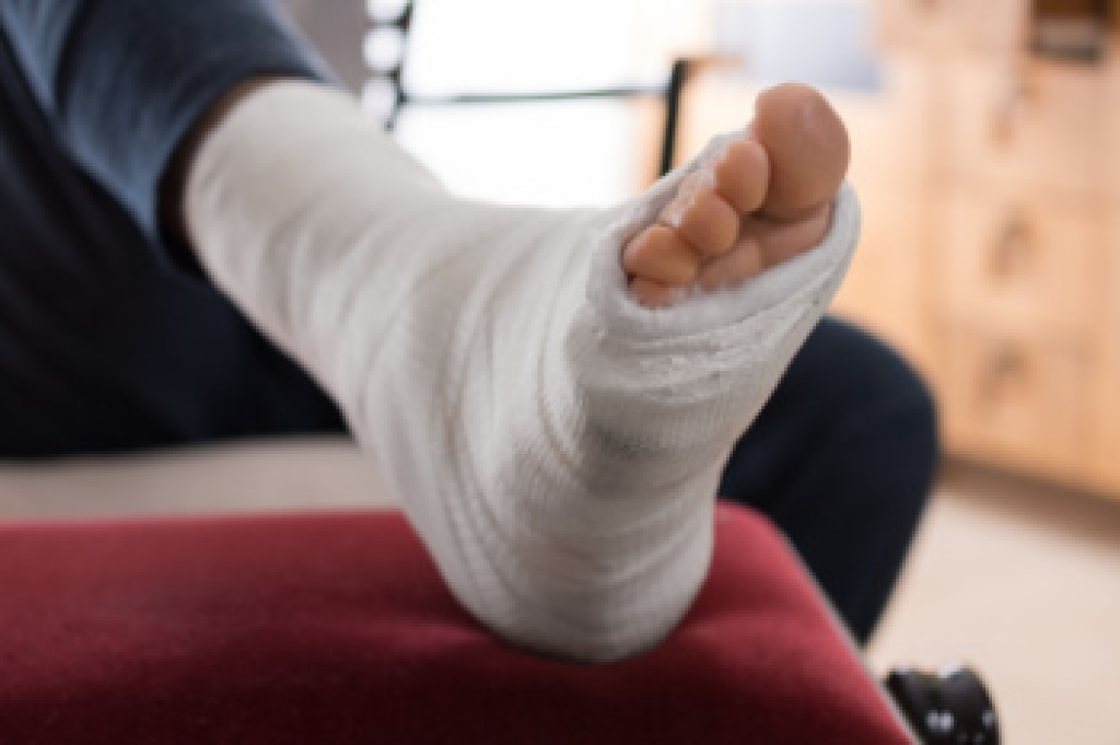 Podiatric Care for a Broken Foot